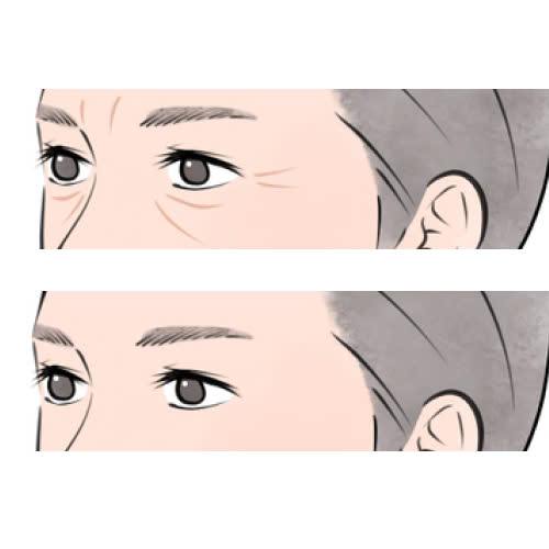 cach-cham-soc-sau-cang-chi-duoi-mat-bi-quyet-giup-hoi-phuc-nhanh-va-duy-tri-hieu-qua-lau-dai