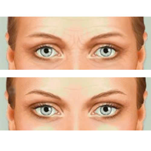 cach-cham-soc-sau-cay-mo-hoc-mat-huong-dan-chi-tiet-tung-giai-doan-hoi-phuc