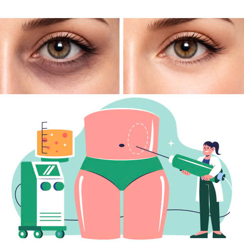 cach-cham-soc-sau-cay-mo-hoc-mat-huong-dan-chi-tiet-tung-giai-doan-hoi-phuc