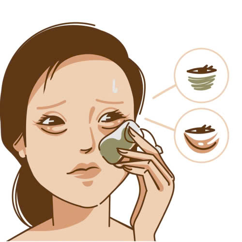 cach-cham-soc-sau-cay-mo-hoc-mat-huong-dan-chi-tiet-tung-giai-doan-hoi-phuc