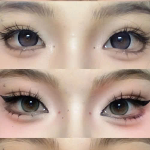 cung-tim-hieu-5-cach-khac-phuc-mat-xech-khong-can-phau-thuat-an-toan-tai-nha