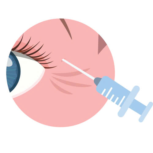 cang-chi-duoi-mat-ket-hop-tiem-filler-bi-quyet-tre-hoa-tu-nhien-giup-cho-doi-mat-rang-ngoi