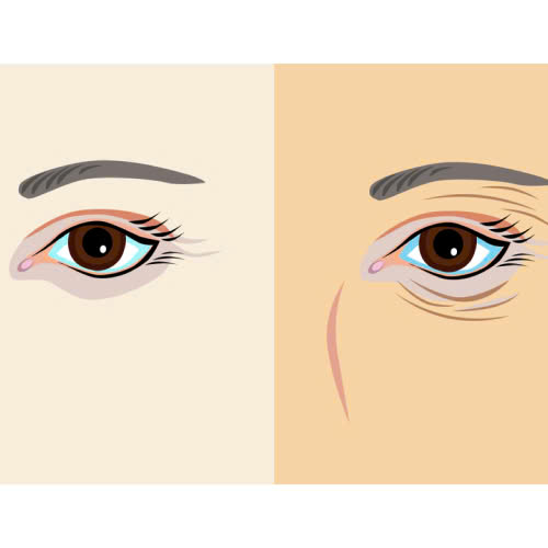 cang-chi-tre-hoa-da-vung-mat-giai-phap-an-toan-khong-xam-lan-cho-doi-mat-rang-ngoi-tuoi-tre