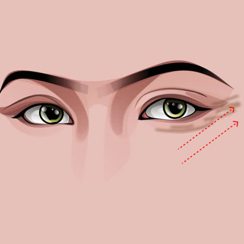 cang-chi-vung-mat-gia-bao-nhieu-4-yeu-to-quan-trong-quyet-dinh-chi-phi-khi-thuc-hien-phuong-phap-cang-chi