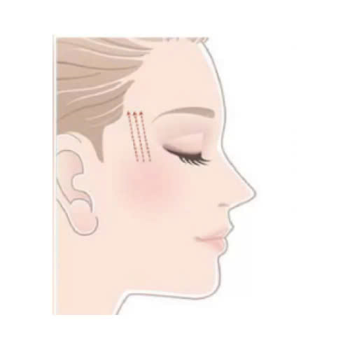 cang-chi-xoa-nhan-duoi-mat-co-nguy-hiem-khong-nhung-dieu-ban-can-biet-truoc-khi-quyet-dinh-thuc-hien-phuong-phap-lam-dep-nay