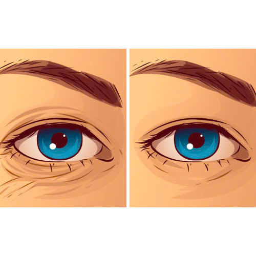 cang-chi-xoa-nhan-duoi-mat-giu-duoc-bao-lau-lam-sao-de-keo-dai-hieu-qua-cang-chi-duoi-mat