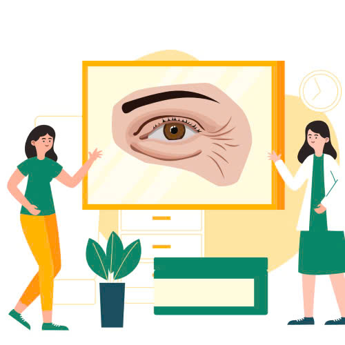 cang-chi-xoa-nhan-vung-mat-bi-quyet-danh-bay-nep-nhan-tra-lai-anh-nhin-tuoi-tre