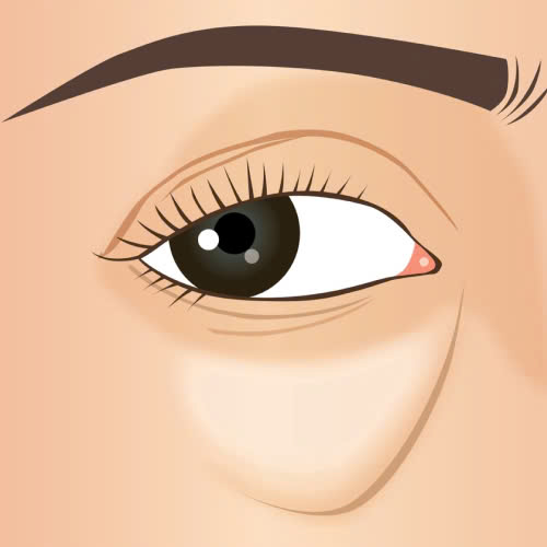 cay-mo-hoc-mat-bi-hong-phai-lam-sao-giai-dap-chi-tiet-dau-hieu-nguyen-nhan-va-cac-giai-phap-khac-phuc-hieu-qua