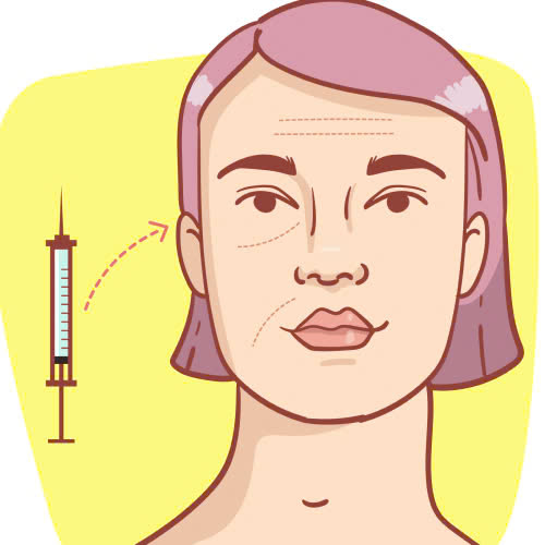 tim-hieu-ly-do-vi-sao-cay-mo-hoc-mat-bi-tieu-mo-nhanh-sau-khi-thuc-hien