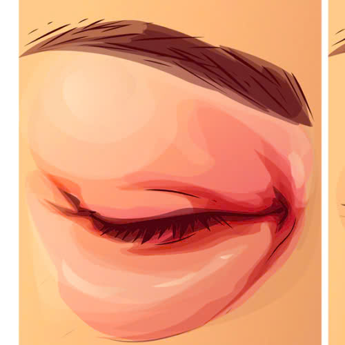 cay-mo-hoc-mat-bi-von-cuc-phai-lam-sao-cung-tim-hieu-nguyen-nhan-cach-khac-phuc-an-toan-va-phong-tranh-hieu-qua