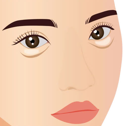 cay-mo-hoc-mat-bi-von-cuc-phai-lam-sao-cung-tim-hieu-nguyen-nhan-cach-khac-phuc-an-toan-va-phong-tranh-hieu-qua