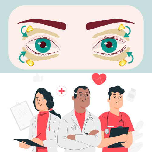 cay-mo-hoc-mat-co-bi-tai-lom-khong-lam-sao-de-han-che-tinh-trang-nay-sau-khi-thuc-hien-cay-mo