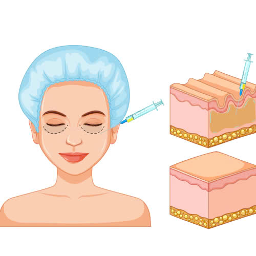 cay-mo-hoc-mat-gia-bao-nhieu-chi-phi-yeu-to-anh-huong-va-nhung-dieu-can-biet