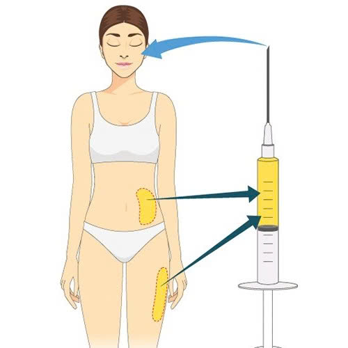 cay-mo-hoc-mat-tu-than-co-tot-khong-nhung-ai-nen-lua-chon-phuong-phap-lam-dep-nay