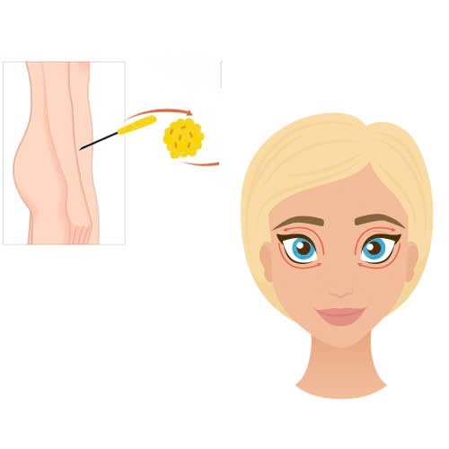 cay-mo-hoc-mat-tu-than-co-tot-khong-nhung-ai-nen-lua-chon-phuong-phap-lam-dep-nay