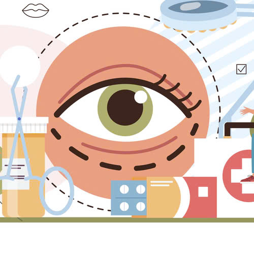 thuc-te-cay-mo-mi-mat-cuoi-co-dau-khong-va-hoi-phuc-trong-bao-lau