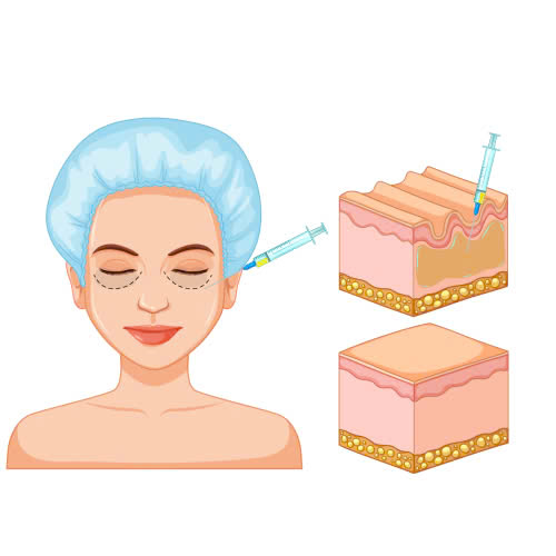 cay-mo-mi-mat-cuoi-la-gi-co-nen-thuc-hien-de-so-huu-anh-nhin-thu-hut-tre-trung