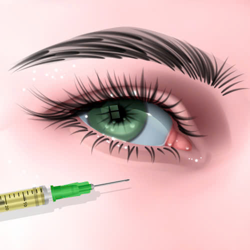 cay-mo-mi-mat-cuoi-la-gi-co-nen-thuc-hien-de-so-huu-anh-nhin-thu-hut-tre-trung