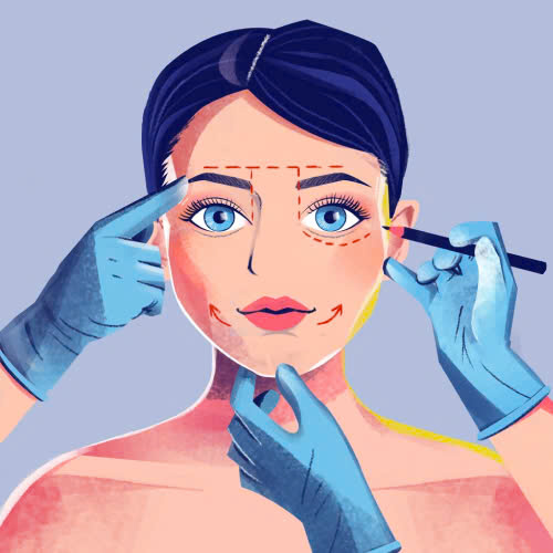 dia-chi-cay-mo-mi-mat-cuoi-uy-tin-cung-tim-hieu-nhung-luu-y-quan-trong-truoc-khi-thuc-hien