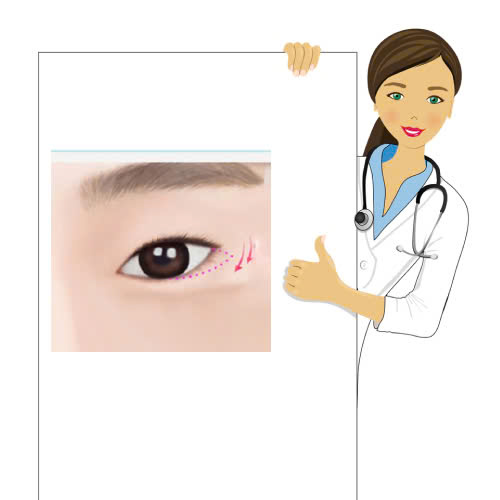 5-tieu-chi-lua-chon-dia-chi-ha-xech-mat-uy-tin-de-tranh-rui-ro-va-dam-bao-hieu-qua