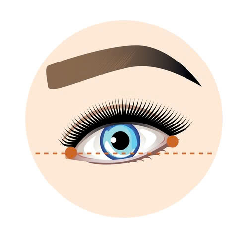 ha-xech-mat-bao-lau-thi-lanh-kinh-nghiem-cham-soc-mat-sau-phau-thuat-ban-nen-biet