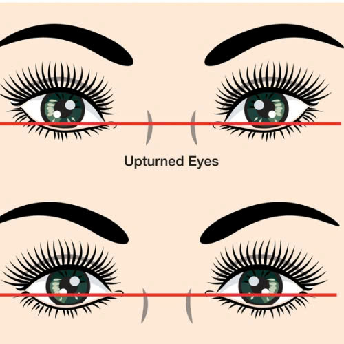 ha-xech-mat-bao-lau-thi-on-dinh-cac-giai-doan-hoi-phuc-ban-can-biet-truoc-khi-thuc-hien