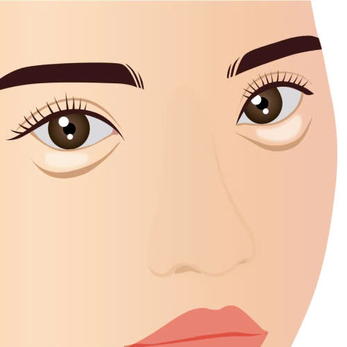 ha-xech-mat-bi-hong-phai-lam-sao-cung-tim-hieu-ve-dau-hieu-nguyen-nhan-va-cach-xu-ly-dung