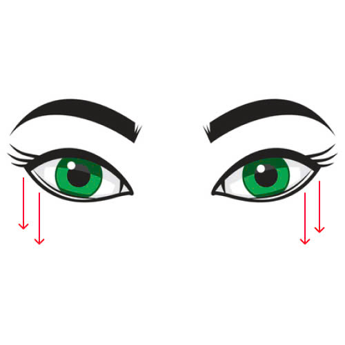 ha-xech-mat-bi-hong-phai-lam-sao-cung-tim-hieu-ve-dau-hieu-nguyen-nhan-va-cach-xu-ly-dung