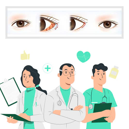 ha-xech-mat-cho-mat-xech-bam-sinh-bi-quyet-giup-anh-mat-sac-sao-tro-nen-diu-dang-hien-hoa