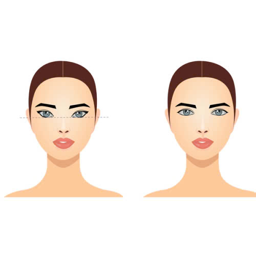 ha-xech-mat-co-dau-khong-bao-lau-thi-se-on-dinh