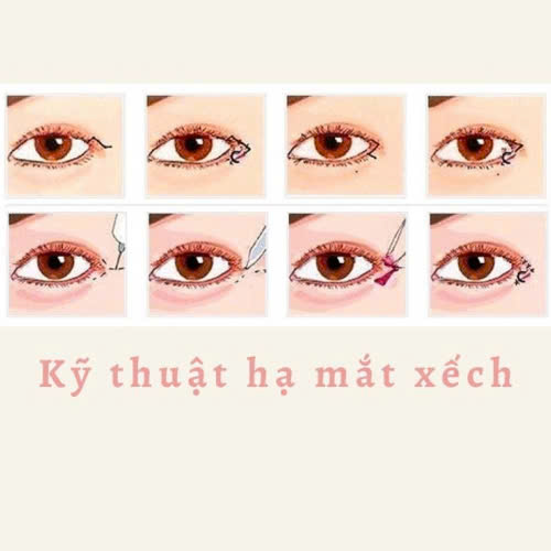 ha-xech-mat-co-de-lai-seo-khong-he-lo-bi-quyet-de-mat-dep-tu-nhien