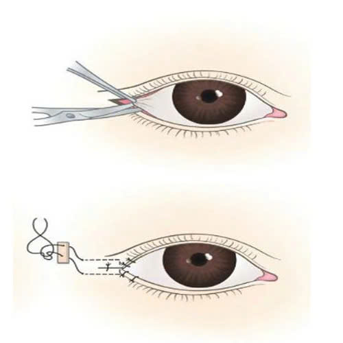 ha-xech-mat-co-de-lai-seo-khong-he-lo-bi-quyet-de-mat-dep-tu-nhien