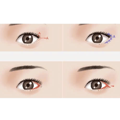 mat-xech-phai-lam-sao-de-guong-mat-hai-hoa-anh-nhin-hien-diu-hon