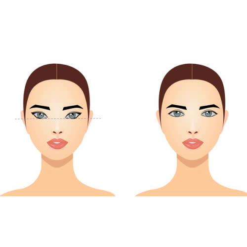 uu-diem-cua-phau-thuat-ha-xech-mat-la-gi-giai-phap-khac-phuc-anh-nhin-du-lay-lai-doi-mat-hien-hoa-diu-dang