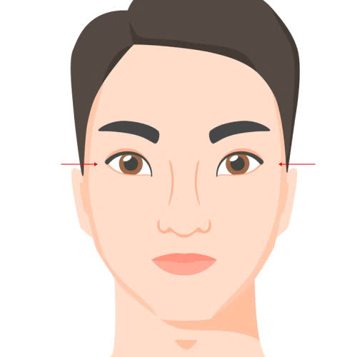 phau-thuat-ha-xech-mat-co-nguy-hiem-khong-nhung-dieu-ban-can-can-nhac-truoc-khi-quyet-dinh-lam-dep