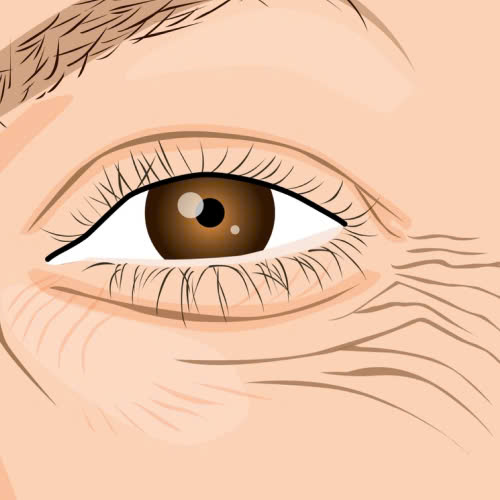 review-cang-chi-xoa-nhan-duoi-mat-thuc-su-phuong-phap-nay-co-hieu-qua-hay-khong