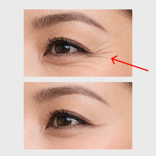 review-cang-chi-xoa-nhan-duoi-mat-thuc-su-phuong-phap-nay-co-hieu-qua-hay-khong