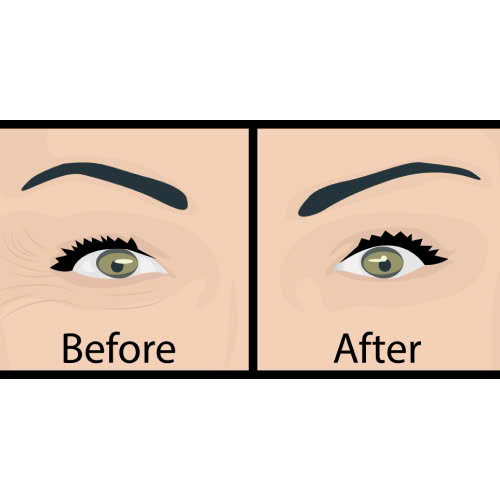 review-cang-chi-xoa-nhan-duoi-mat-thuc-su-phuong-phap-nay-co-hieu-qua-hay-khong