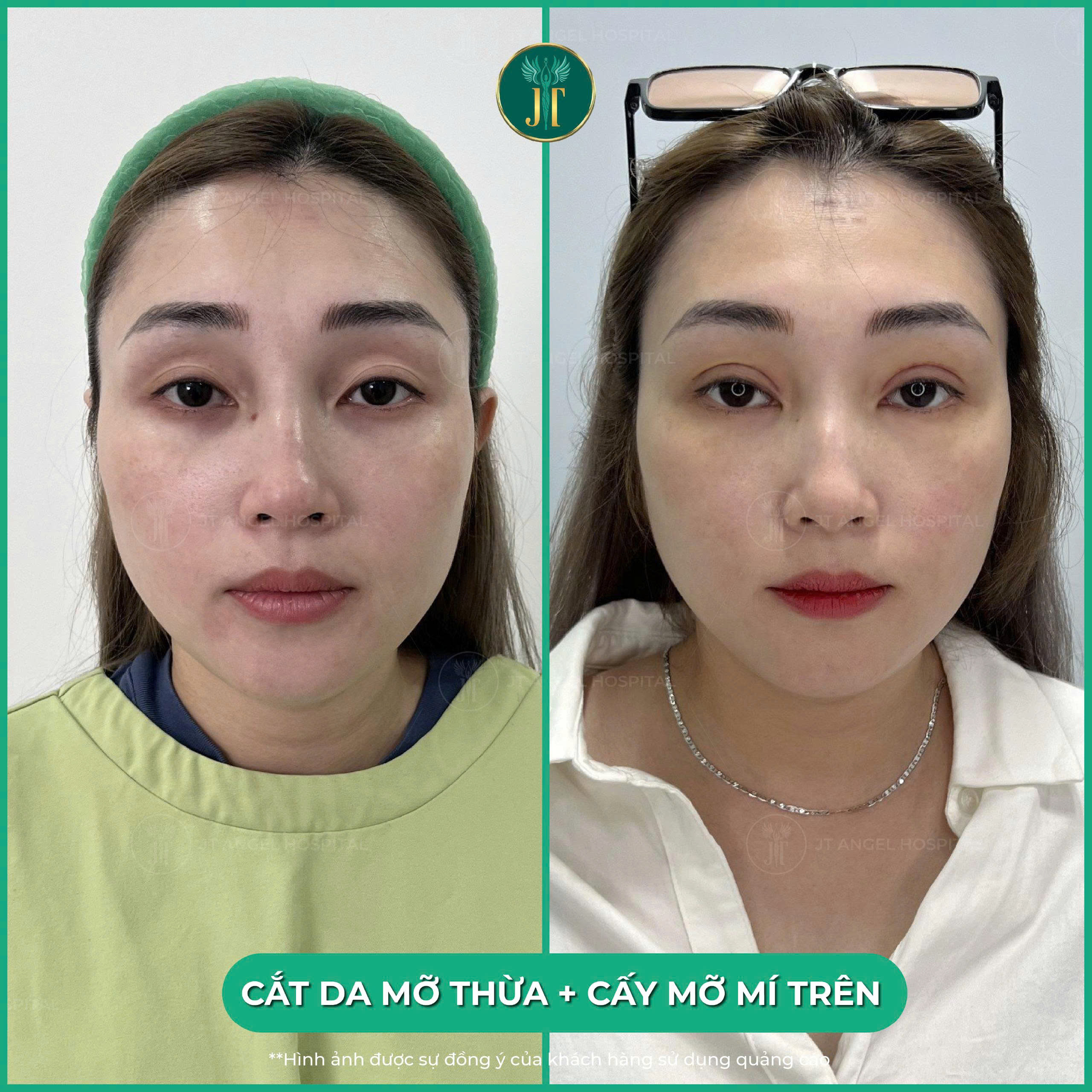 review-cay-mo-hoc-mat-nhung-danh-gia-chan-thuc-tu-khach-hang-thuc-te