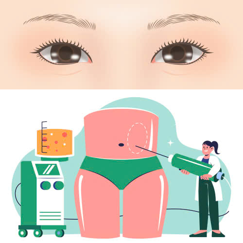 cach-cham-soc-sau-cay-mo-mi-mat-cuoi-giup-doi-mat-hoi-phuc-nhanh-va-dep-tu-nhien