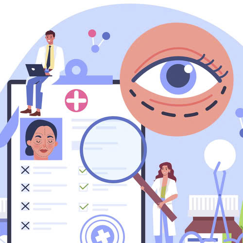 cay-mo-mi-mat-cuoi-hay-tiem-filler-tot-hon-lua-chon-nao-se-phu-hop-voi-ban