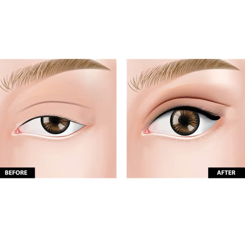 nang-co-mi-co-dau-khong-sau-khi-thuc-hien-dich-vu-co-can-nghi-duong-khong