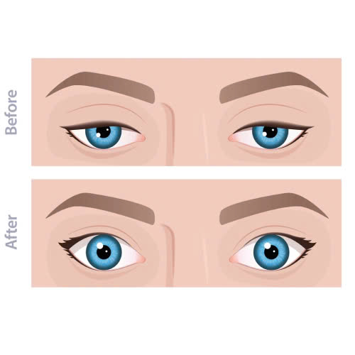 nang-co-mi-gia-bao-nhieu-phuong-phap-lam-dep-nay-co-dang-de-dau-tu-khong