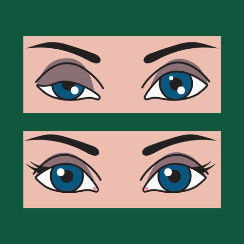 nang-co-mi-la-gi-giai-phap-khac-phuc-sup-mi-mang-lai-doi-mat-tuoi-tre