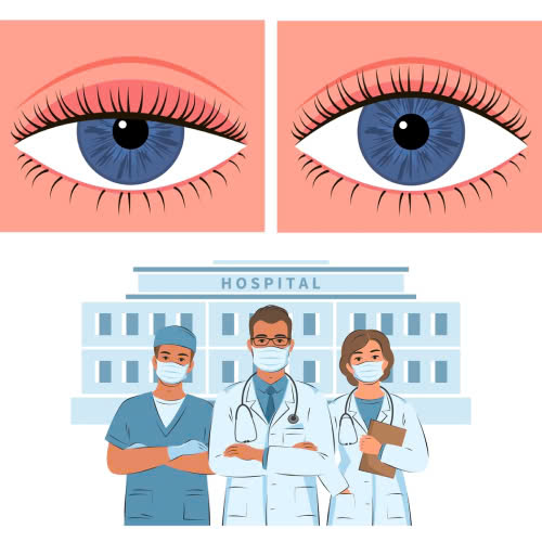 nang-co-mi-mat-co-nguy-hiem-khong-doi-tuong-nao-nen-va-khong-nen-thuc-hien-phuong-phap-nay