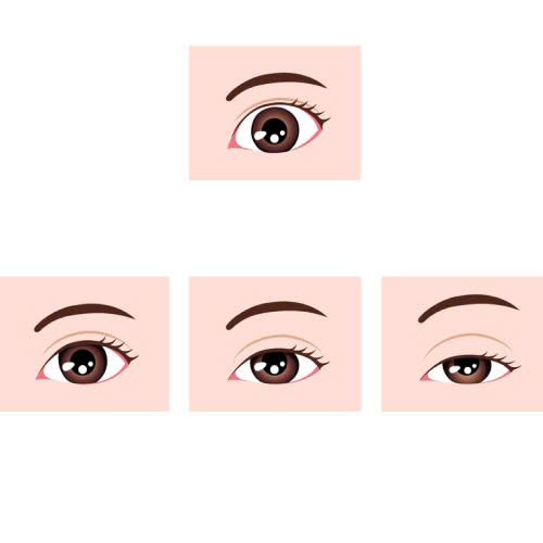 nang-co-mi-mat-co-nguy-hiem-khong-doi-tuong-nao-nen-va-khong-nen-thuc-hien-phuong-phap-nay