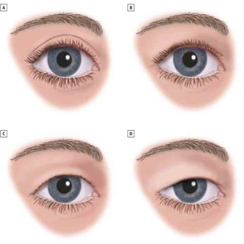 nang-co-mi-sup-mi-bi-quyet-giup-ban-tre-hoa-doi-mat-va-cai-thien-tam-nhin-hieu-qua