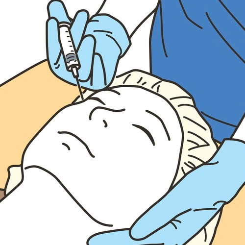 phau-thuat-cay-mo-mi-mat-cuoi-la-gi-uu-diem-noi-bat-cua-phuong-phap-nay-phu-hop-voi-ai