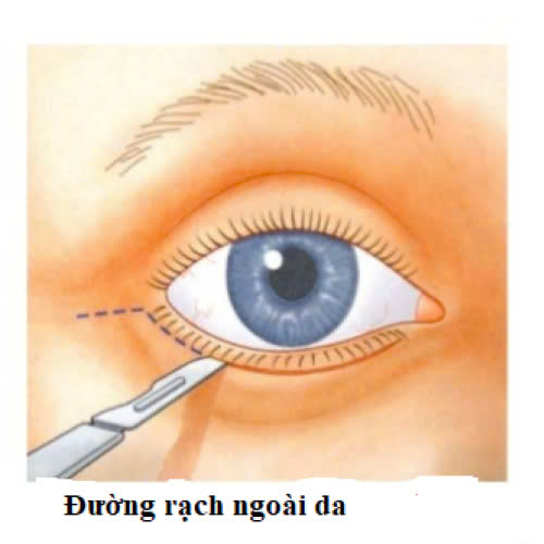 huong-dan-chi-tiet-cach-cham-soc-sau-ha-bau-mat-giup-phuc-hoi-nhanh-va-mat-dep-tu-nhien-an-toan