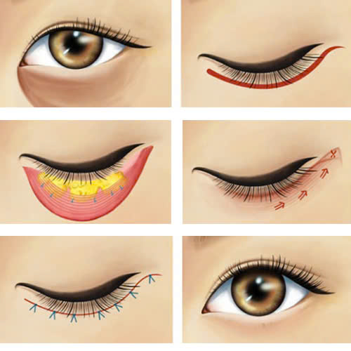 huong-dan-chi-tiet-cach-cham-soc-sau-ha-bau-mat-giup-phuc-hoi-nhanh-va-mat-dep-tu-nhien-an-toan